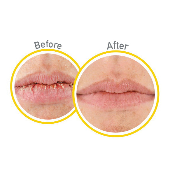 O'Keeffe's K0900002 SPF 35 Lip Repair Balm, 0.15 oz, Stick